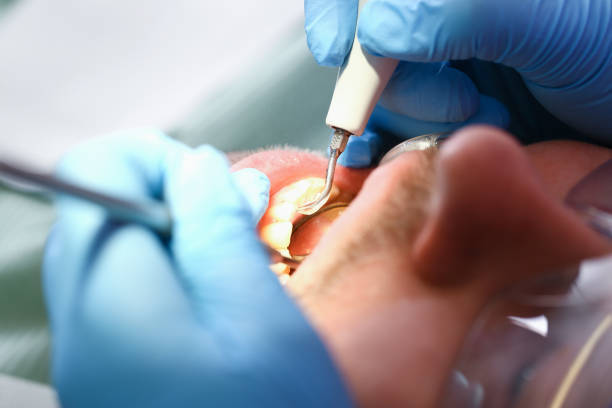 Best Weekend Emergency Dentist in Platte City, MO